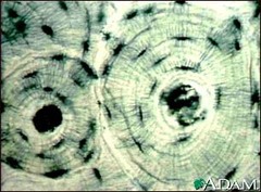 <p>tissue type that is the basis of the skeletal system</p>