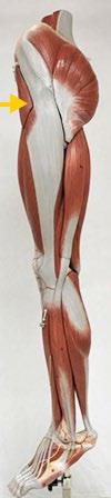 <p>Tensor fascia latae</p>