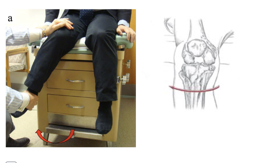 <p><span>Which of the following are the synergists of the motion depicted below? Select all that apply.</span></p>