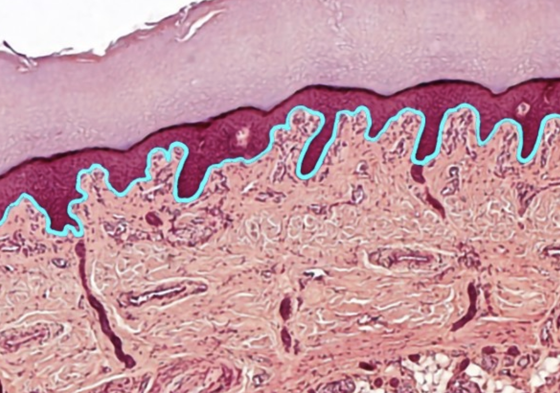 term image