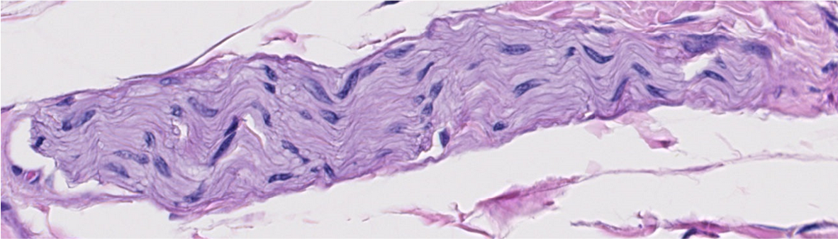 <p><span style="font-family: "Calibri Light";">Is this nerve fascicle myelinated or unmyelinated?</span></p>