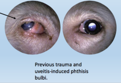 <p>What are the traits of phthisis bulbi?</p>