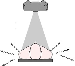 <p>ionizing radiation that occurs as a result of the interaction between the primary x-ray beam and matter. It is emitted from the matter in all directions during the exposure, tending to fog the image and produce a radiation hazard in the room. The patient is the principal source of scatter radiation that occurs during radiography.</p>