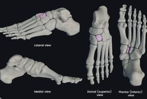 <p>Which bone is this?</p>