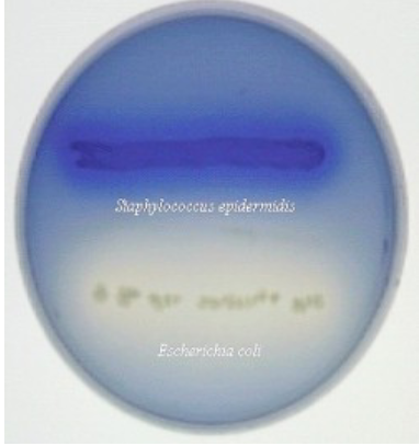 <p>blue and clearing of fat droplets around growth</p>