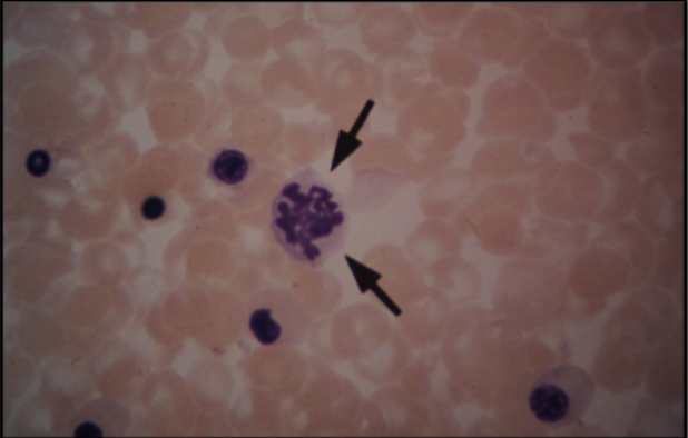 <p>This image shows?</p>