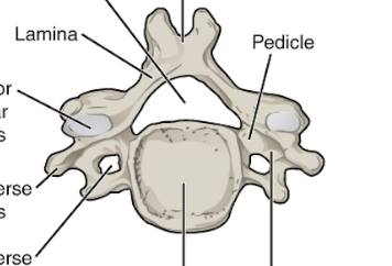 <p>What is the hole called?</p>