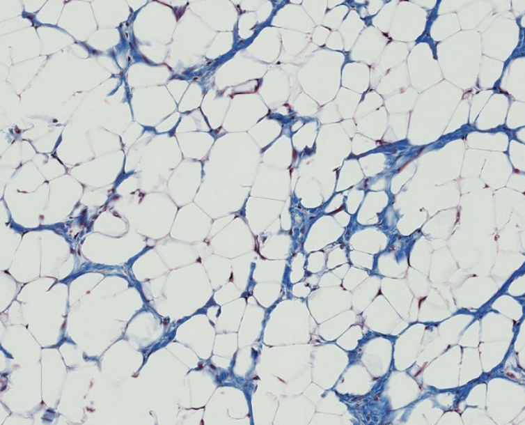 <p>which basic type of CT is this? be specific.</p><p></p>